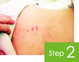 とみ鍼灸治療院 治療の流れstep2